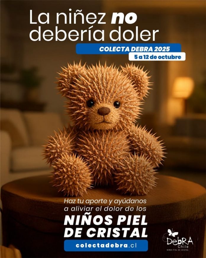 DEBRA