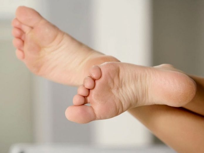 El pie diabético se consolida como una de las principales causas de amputación de extremidades en Chile